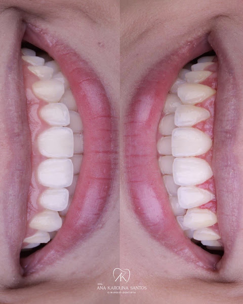 Foto 3 de Dra. Ana Karolina Santos | Odontologia Estética e Integrada