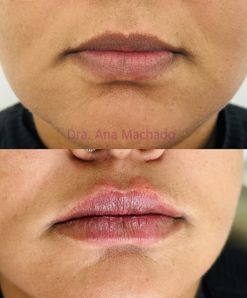 Foto de Dra. Ana Machado | Harmonização Facial