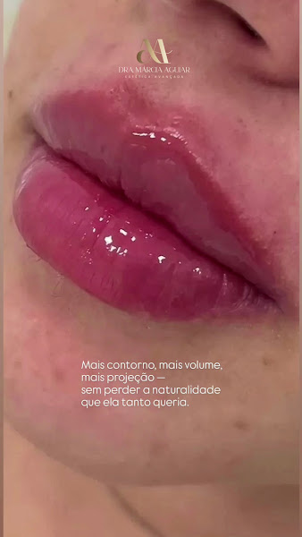 Foto 3 de Dra Ana Márcia Aguiar | Harmonização Facial | Cachoeiro de Itapemirim