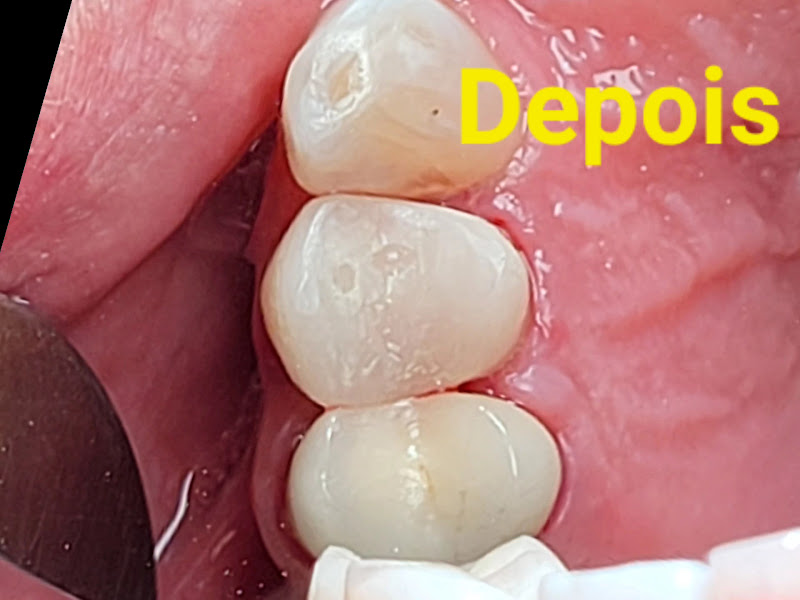 Foto 7 de Dra Ana Paula Bittencourt Odontologia