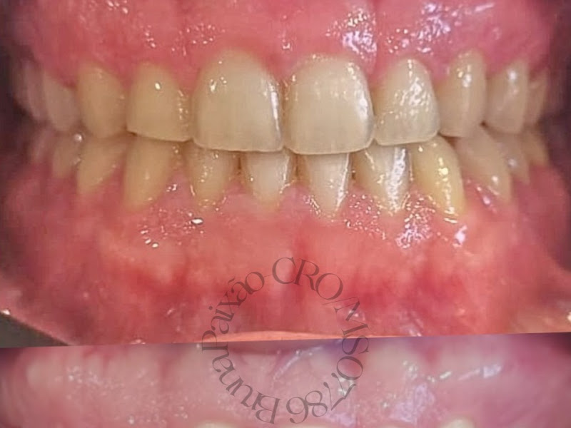 Foto 3 de Dra. Ana Paula Mesquita Marques - Invisalign Doctor