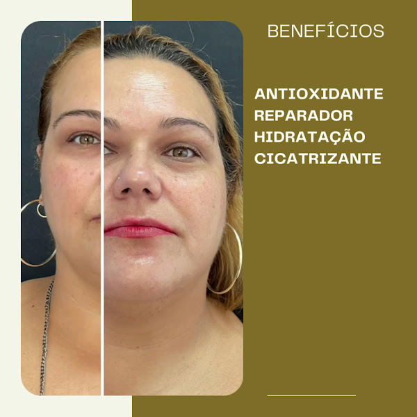 Foto 2 de Dra. Ana Paula Pinho | Harmonização Facial, Line Skin e Clínica de Estética