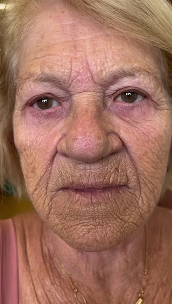 Foto 3 de Dra. Ana Paula Pinho | Harmonização Facial, Line Skin e Clínica de Estética