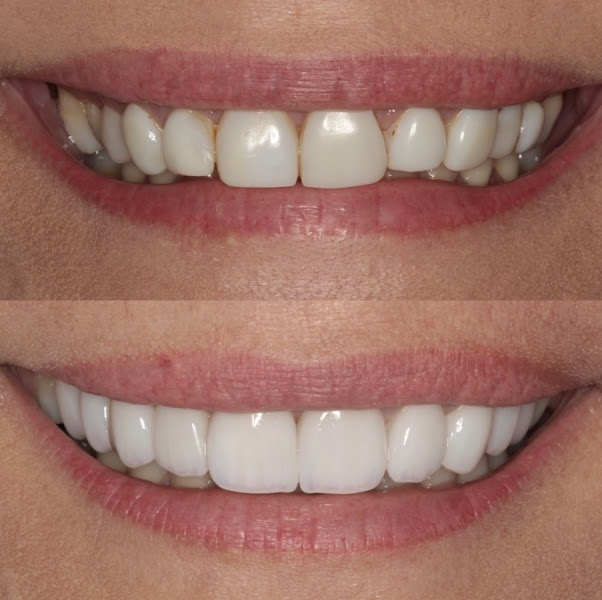 Foto 3 de Dra. Ana Paula Rodrigues | Implantes e Estética Dental em Goiânia