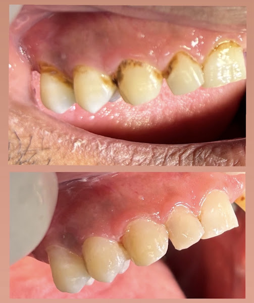 Foto 2 de Dra Ana Victória Dentista
