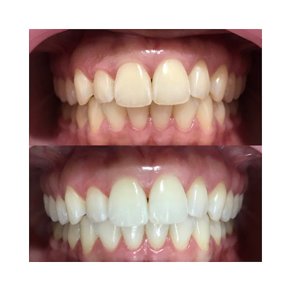 Foto 3 de Dra. Ananda Jasson- Dentista. Tratamento de canal- Clareamento dental- Prótese Dentária- Cirurgias-