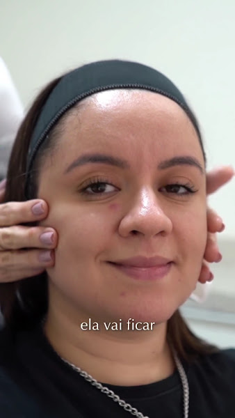 Foto 3 de Dra. Andrea Andrucioli - Harmonização Orofacial