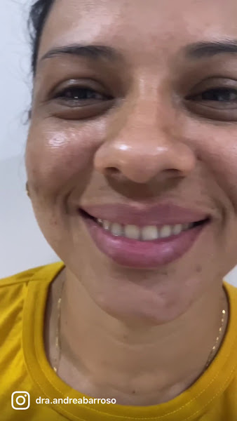 Foto 3 de Dra. Andréa Barroso-Lentes em Resina em Macapá