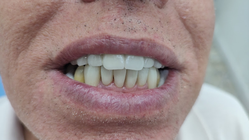 Foto 3 de Dra. Andrea Leonardo (Cirurgiã Dentista, Implantodontia e Harmonização Facial)