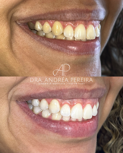Foto 3 de Dra. Andréa Pereira - Odontologia e Harmonização Orofacial