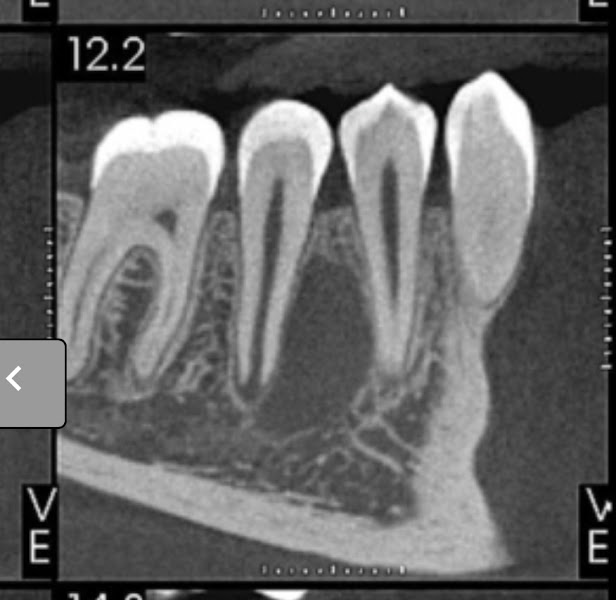 Foto 3 de Dra Andreia Neugebauer Barraz | Dentista em Pelotas