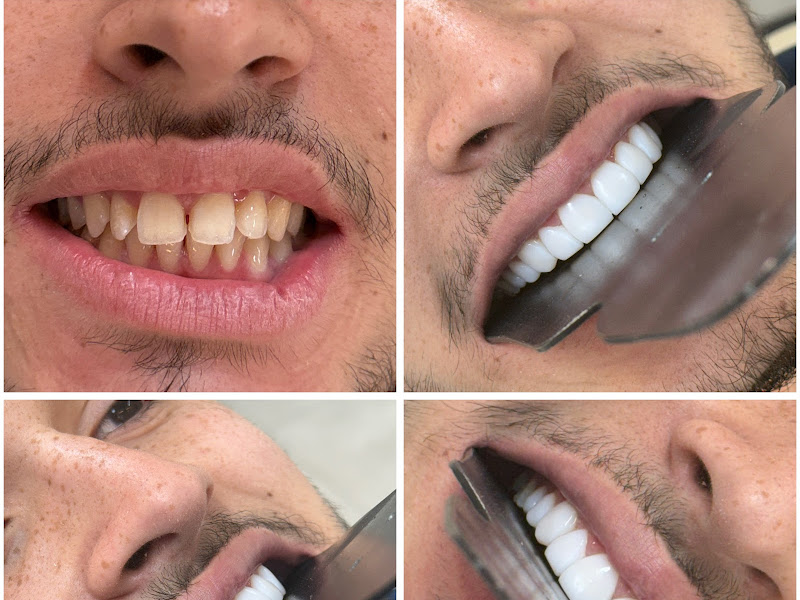 Foto 8 de Dra. Andréia Oliveira - Cirurgiã Dentista