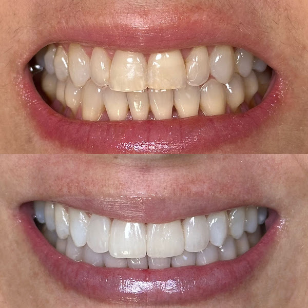 Foto 2 de Dra.Andressa Reis / Facetas Naturais