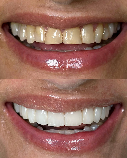 Foto 3 de Dra.Andressa Reis / Facetas Naturais