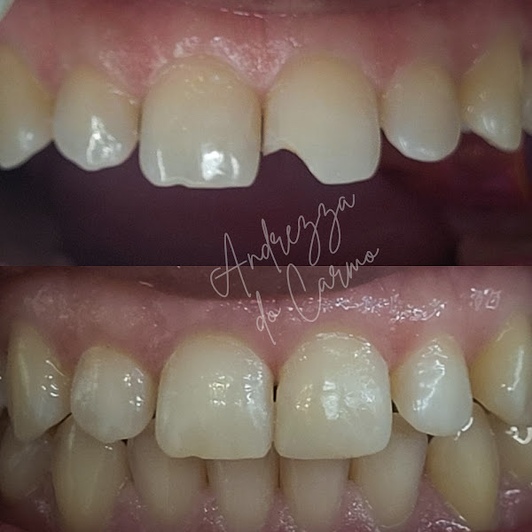 Foto 3 de Dra. Andrezza do Carmo