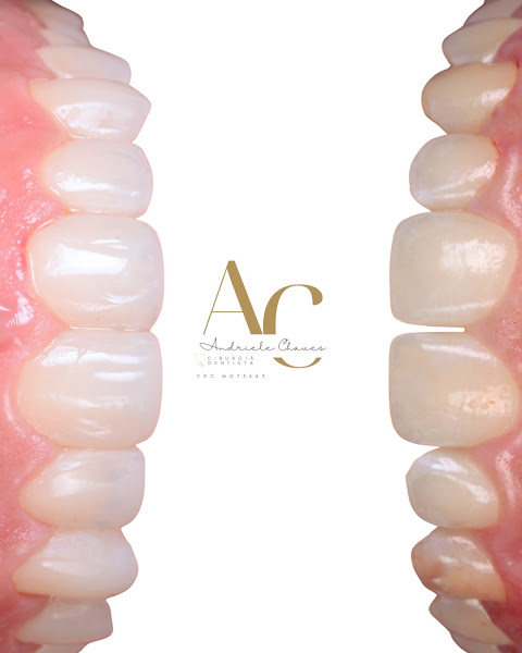 Foto 2 de Dra Andriele Chaves Cirurgiã Dentista
