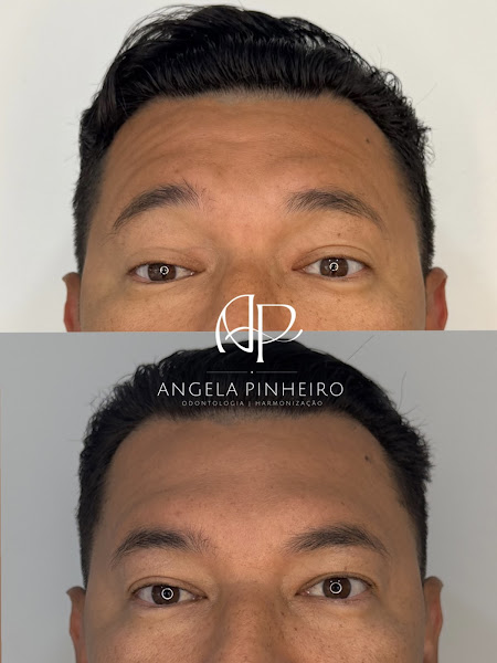 Foto 3 de Dra. Angela Pinheiro - Harmonização Orofacial