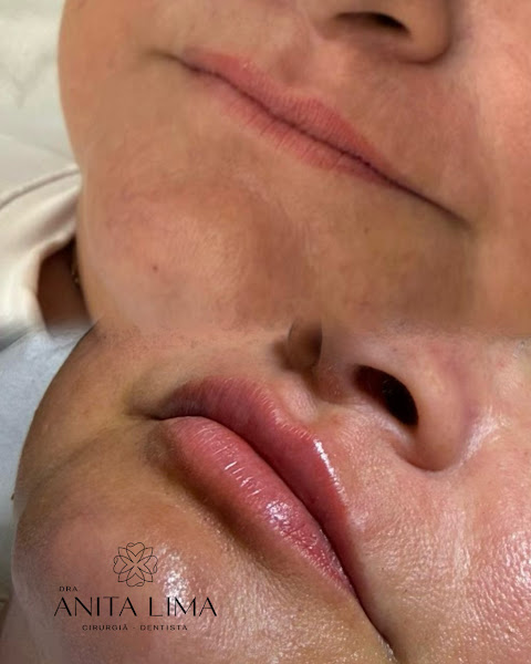 Foto 2 de Dra. Anita Lima - Cirurgiã-dentista