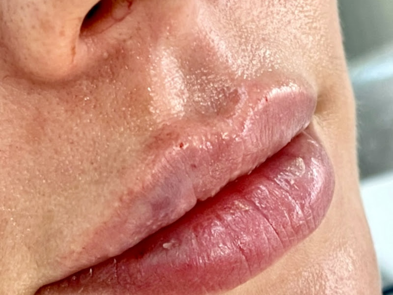 Foto 8 de Dra. Anna Carolina Pinheiro Craveiro