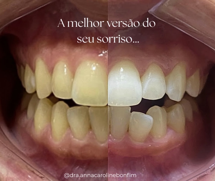 Foto 2 de Dra. Anna Caroline Bonfim