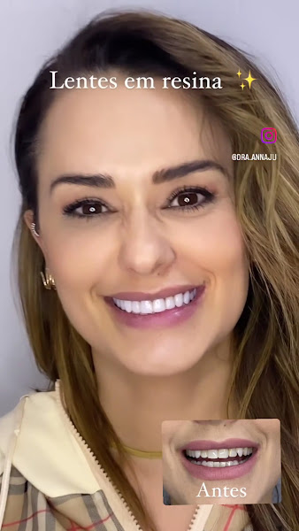 Foto 5 de Dra Anna Júlia - Dentista - Estética dental