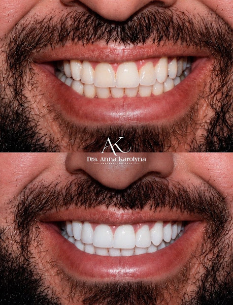 Foto 2 de Dra. Anna Karolyna Cintra | Dentista Anápolis