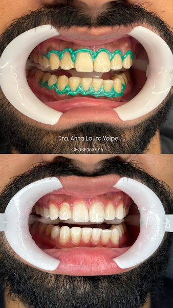 Foto 2 de Dra. Anna Laura Volpe - Dentista Rio Preto 24H