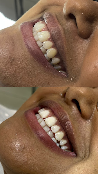 Foto 2 de Dra. Anna Vitória | Dentista em Anápolis