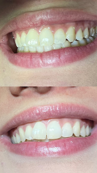 Foto 3 de Dra. Anna Vitória | Dentista em Anápolis