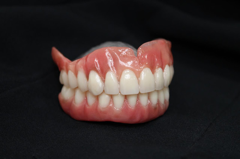 Foto 3 de Dra. Anny Tura - Implantodontista