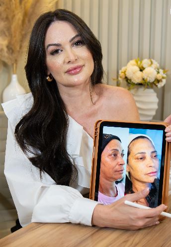 Foto 2 de Dra. Antônia Fernandes - Harmonização Facial