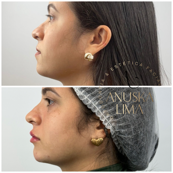 Foto 3 de Dra. Anuska Lima | Harmonização Facial e Ortodontia em Salvador