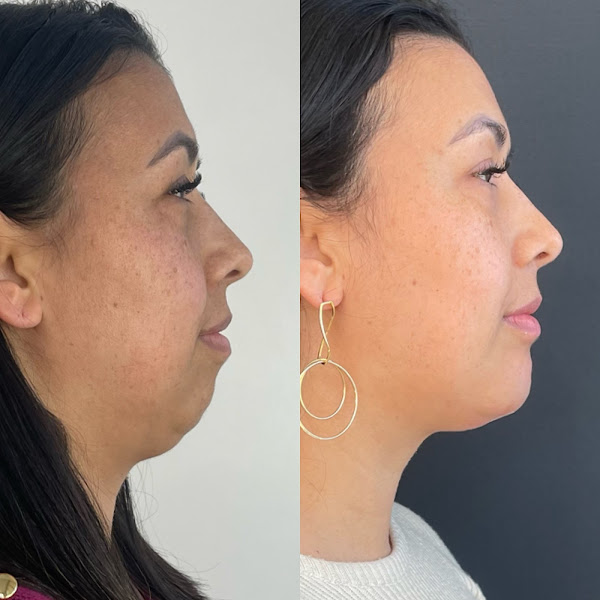 Foto 3 de Dra. Ariane Camargo | Harmonização Facial e Estética Avançada