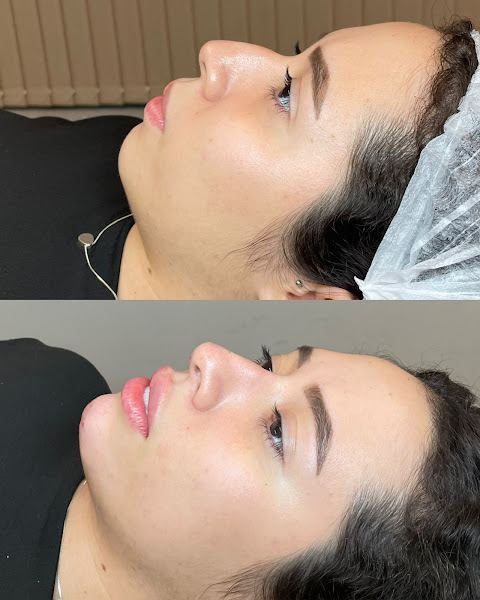 Foto 3 de Dra. Ariane Figueira - Harmonização Facial