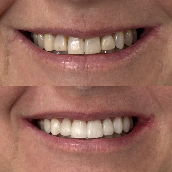 Foto 3 de Dra. Aritana Lopes Severo | Lentes de Resina e Periodontia | Pelotas-RS