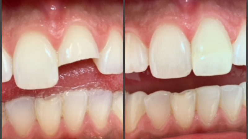 Foto 2 de Dra Astrid Ferreira Odontologia Estética