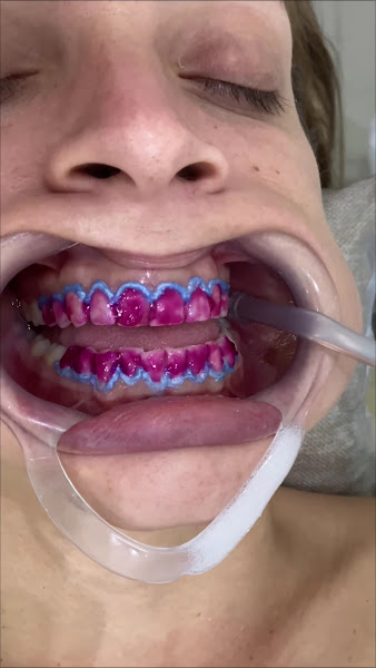 Foto 3 de Dra Ayla Rita, Dentista