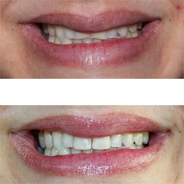 Foto 3 de Dra. Bárbara Lima | Cirurgiã Dentista em Gravataí