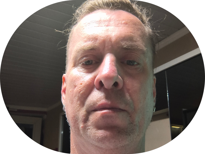 Foto 7 de Dra. Bárbara Lima | Cirurgiã Dentista em Gravataí