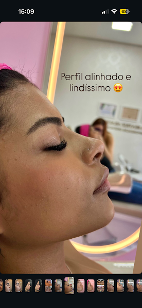Foto 2 de Dra Beatriz Araujo Harmonização Orofacial