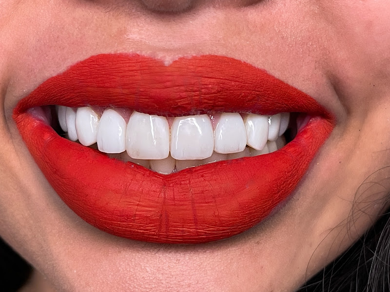 Foto 3 de Dra. Beatriz Cristina, Odontologia Estética e Harmonização Orofacial