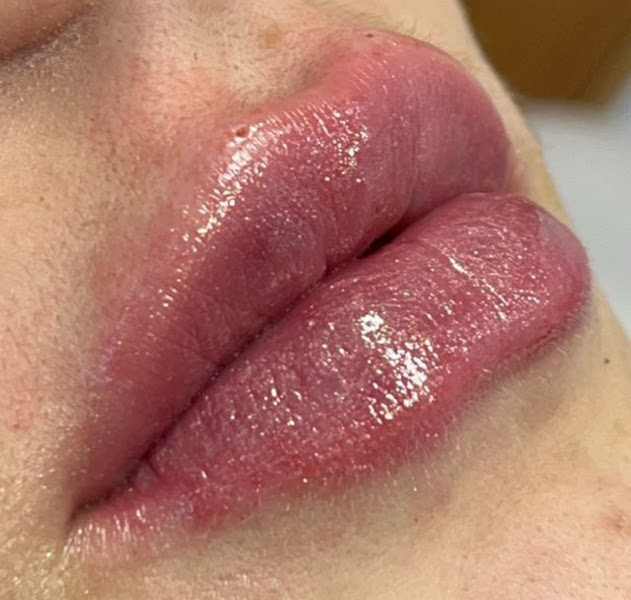 Foto 2 de Dra. Beatriz Gallego Castilho - Dentista/Harmonização/Expert Clareamento a laser/ Canal / Capacitada em Urgências pela UFU