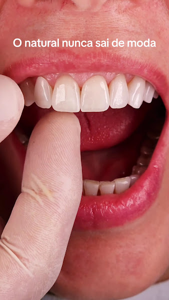 Foto 4 de Dra. Beatriz Kawamoto | Dentista Brooklin | Implante Dentário | Lente de Contato Dental | Tratamento de Canal | Sedação