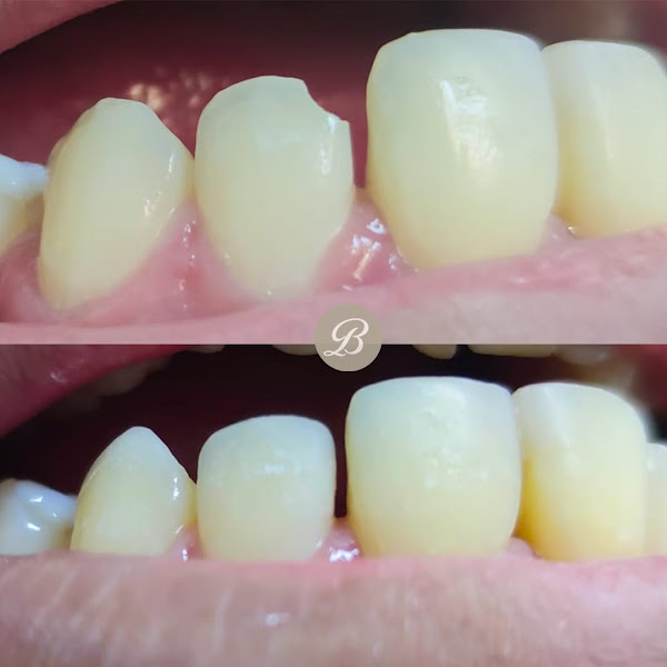 Foto 3 de Dra. Beatriz Laureano | Odontologia