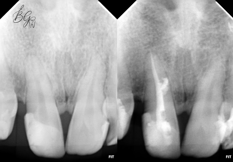 Foto 2 de Dra. Beatriz Monteiro Gichet - Dentista/ Endodontista