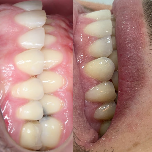Foto 3 de Dra Beatriz Oliveira - Dentista na Pauliceia