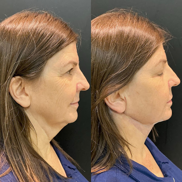 Foto 3 de Dra Beatriz Schafhauser Odontologia E Harmonização Orofacial