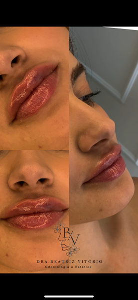 Foto 2 de Dra.Beatriz Vitório - Odontologia e Estética
