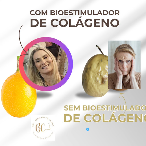Foto 3 de Dra. Bernadete Cunha | Vitalderma Estética | Harmonização Facial