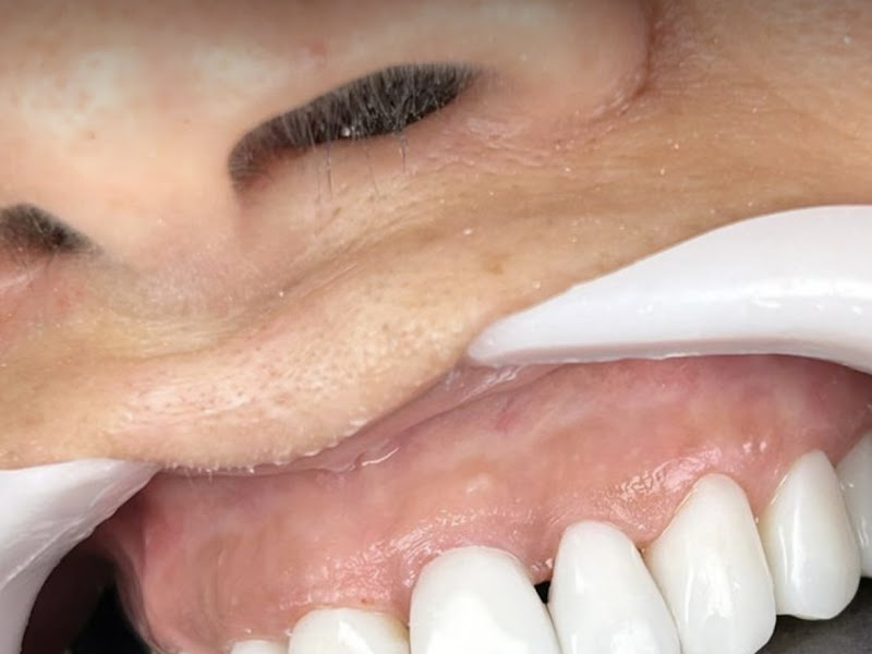 Foto 8 de Dra. Betinne Erdmann | Erdmann Odontología | Cirurgiã Dentista em Porto Alegre